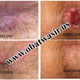 Illustration for article titled Obat Wasir Ambeien dari Daun Ungu